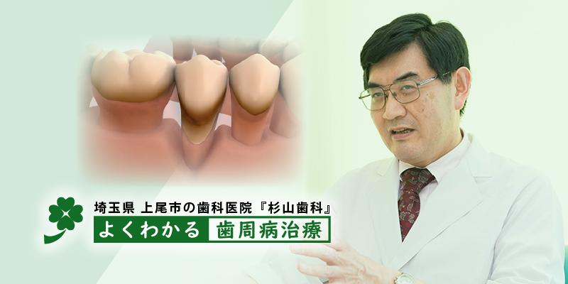 よくわかる歯周病治療